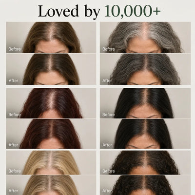 Yeowoo Scalp Revival Bar