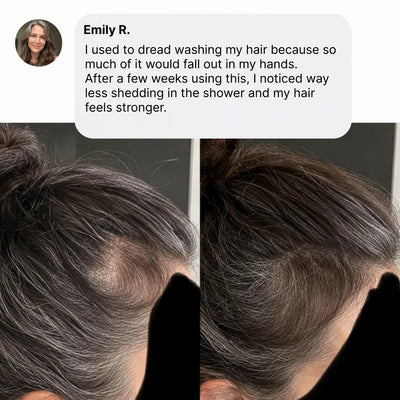 Yeowoo Scalp Revival Bar